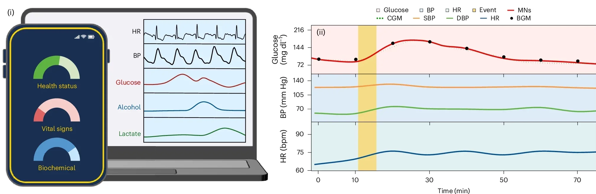 A laptop displays parallel signal recording of the ultrasound sensors for BP and the microneedles of three biomarker readings (glucose, alcohol and lactate).