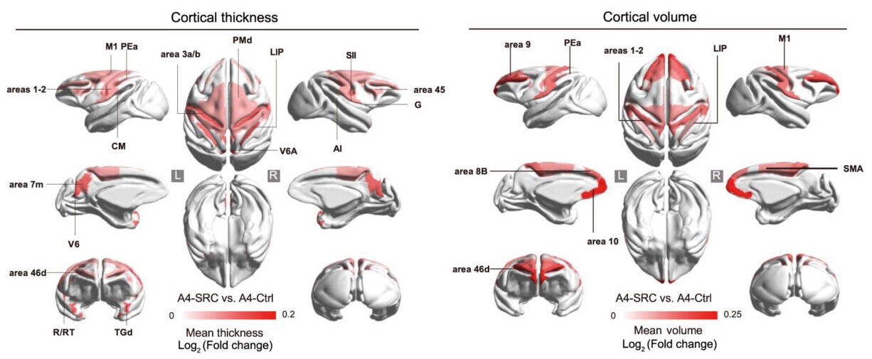 SRC treatment alleviates aging-related brain atrophy and structural connection decline by MRI analysis