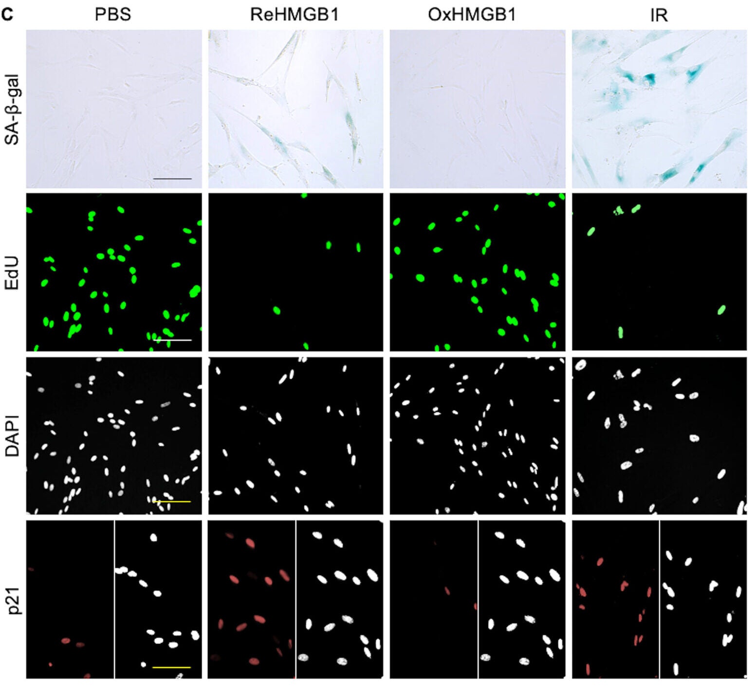 Redox state of HMGB1 confers senescence-like phenotypes in cultured fibroblasts.