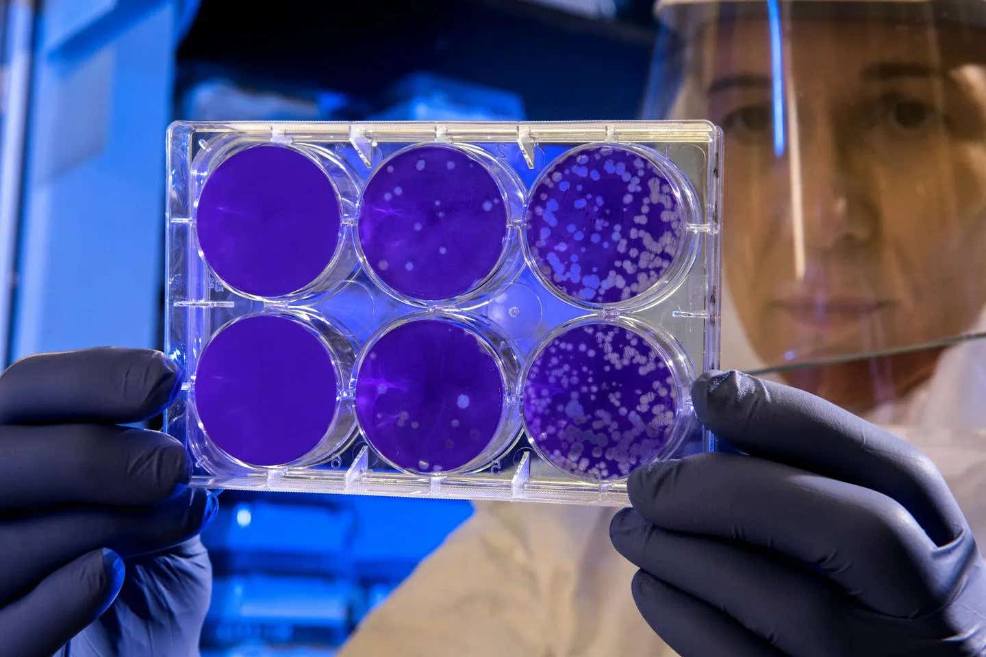 Scientists discover PopA, a strange protein in bacteria that traps lipids and changes how microbes interact with their world.