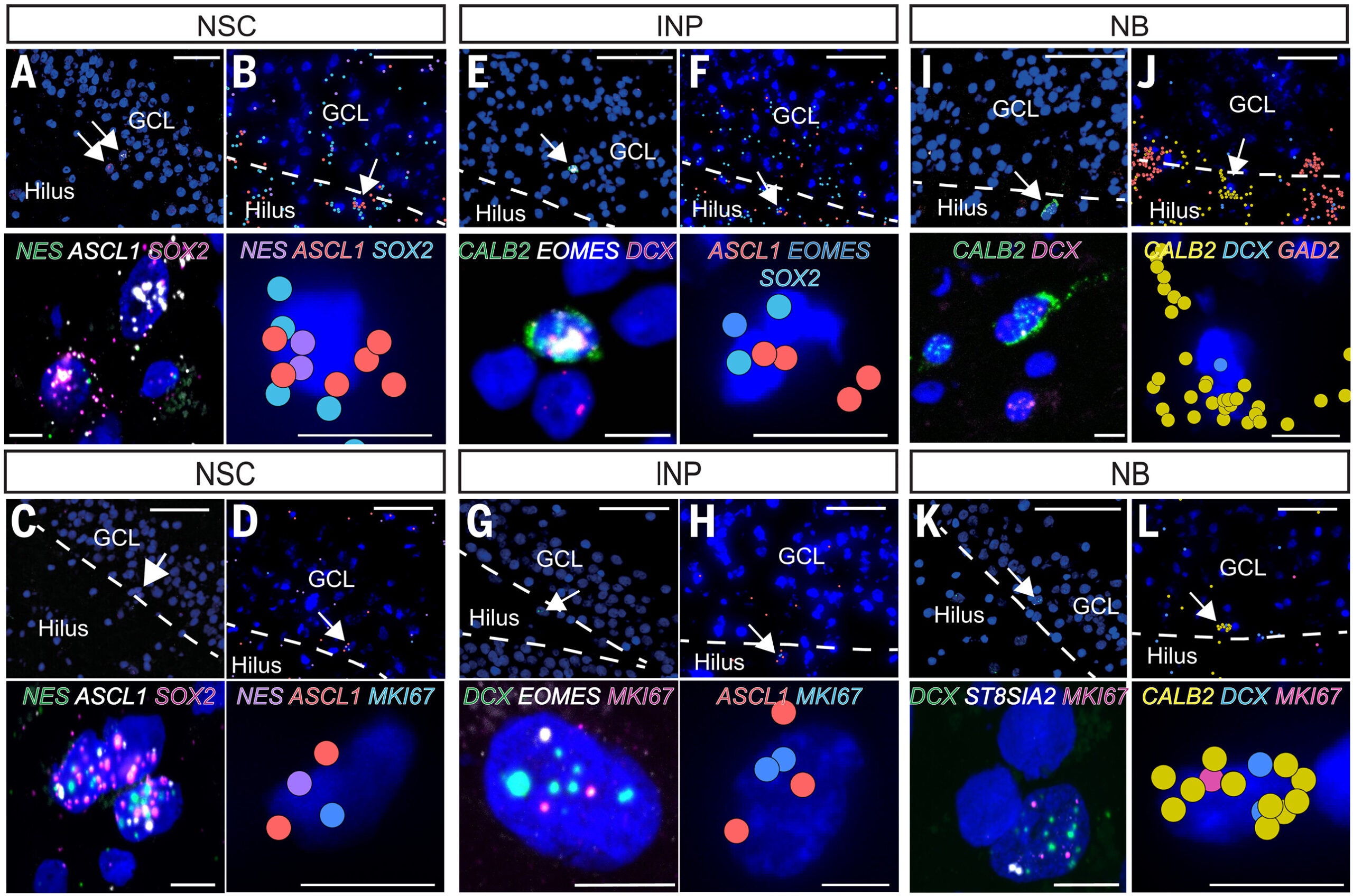 Single-cell transcriptomic characterization of adult human neural progenitors and of the human neurogenic niches with spatial resolution.