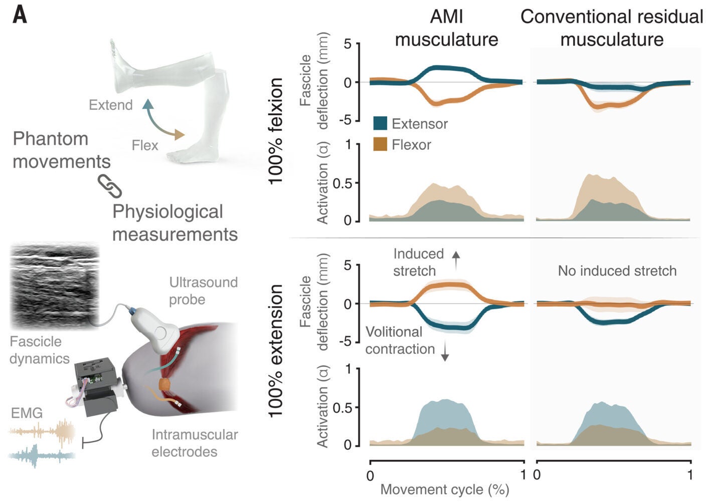  Agonist-antagonist architecture increases proprioceptive feedback associated with phantom knee movement.