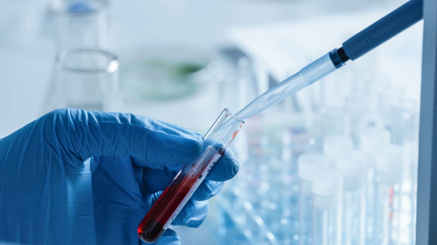 CXCL12 may help scientists mass-produce artificial red blood cells by triggering key steps in their development.