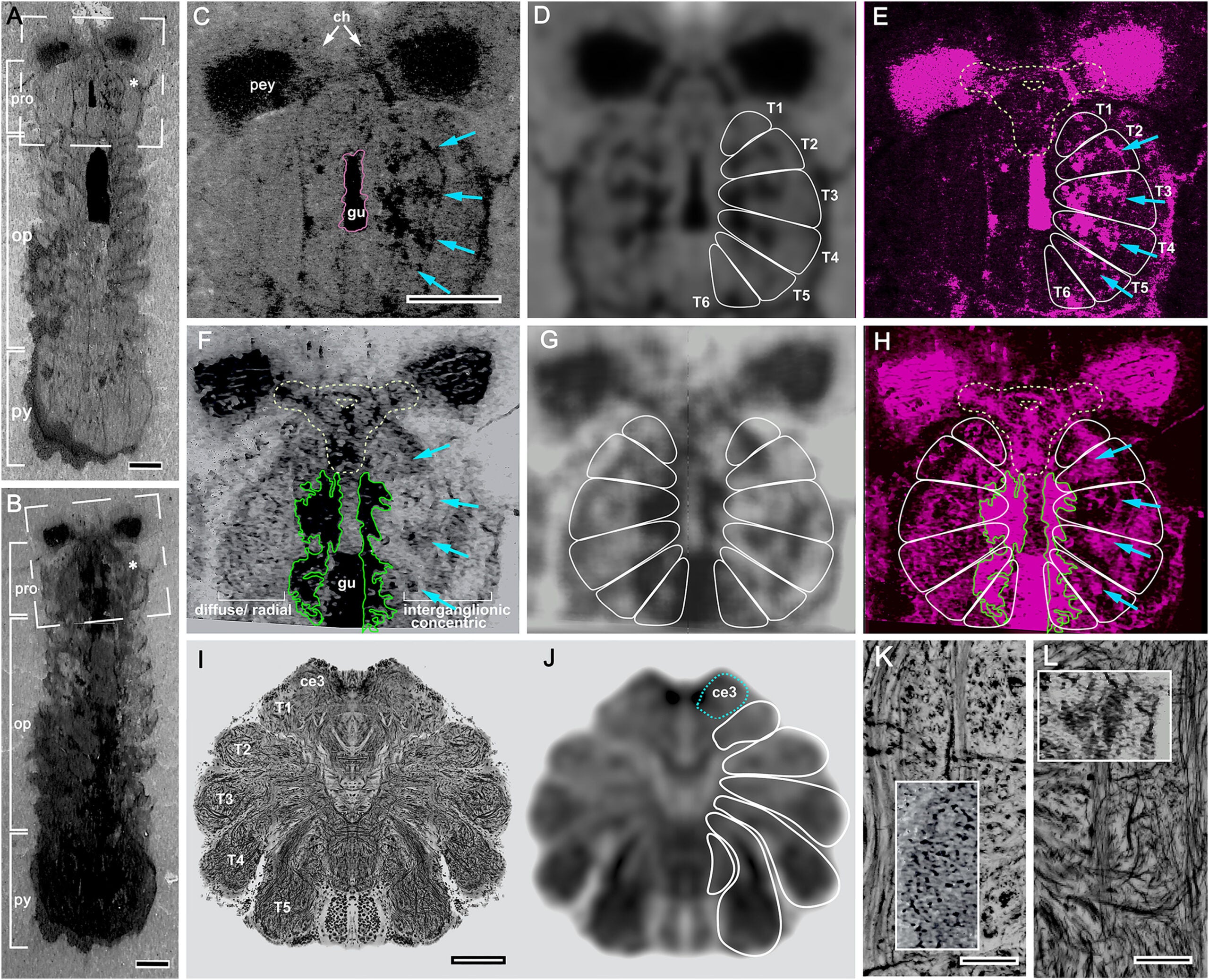 Mollisoniid prosomal nervous system conforms to the arachnid ground pattern
