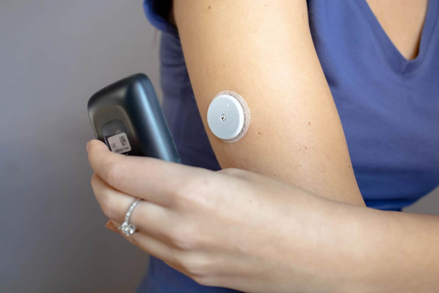 New wearable microneedle device tracks glucose and meds in real time for safer, personalized diabetes care.