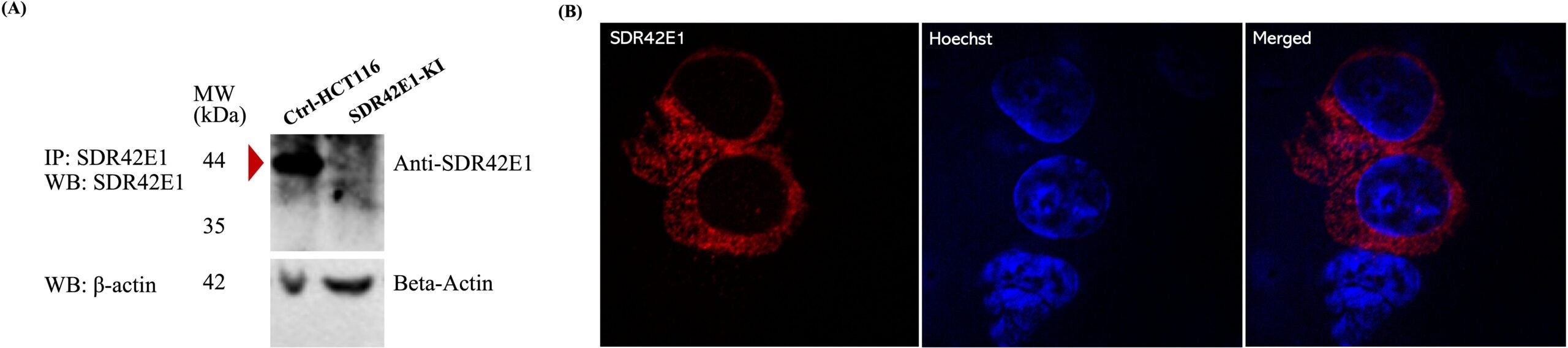 Localization and expression of SDR42E1 protein in HCT116 cells.