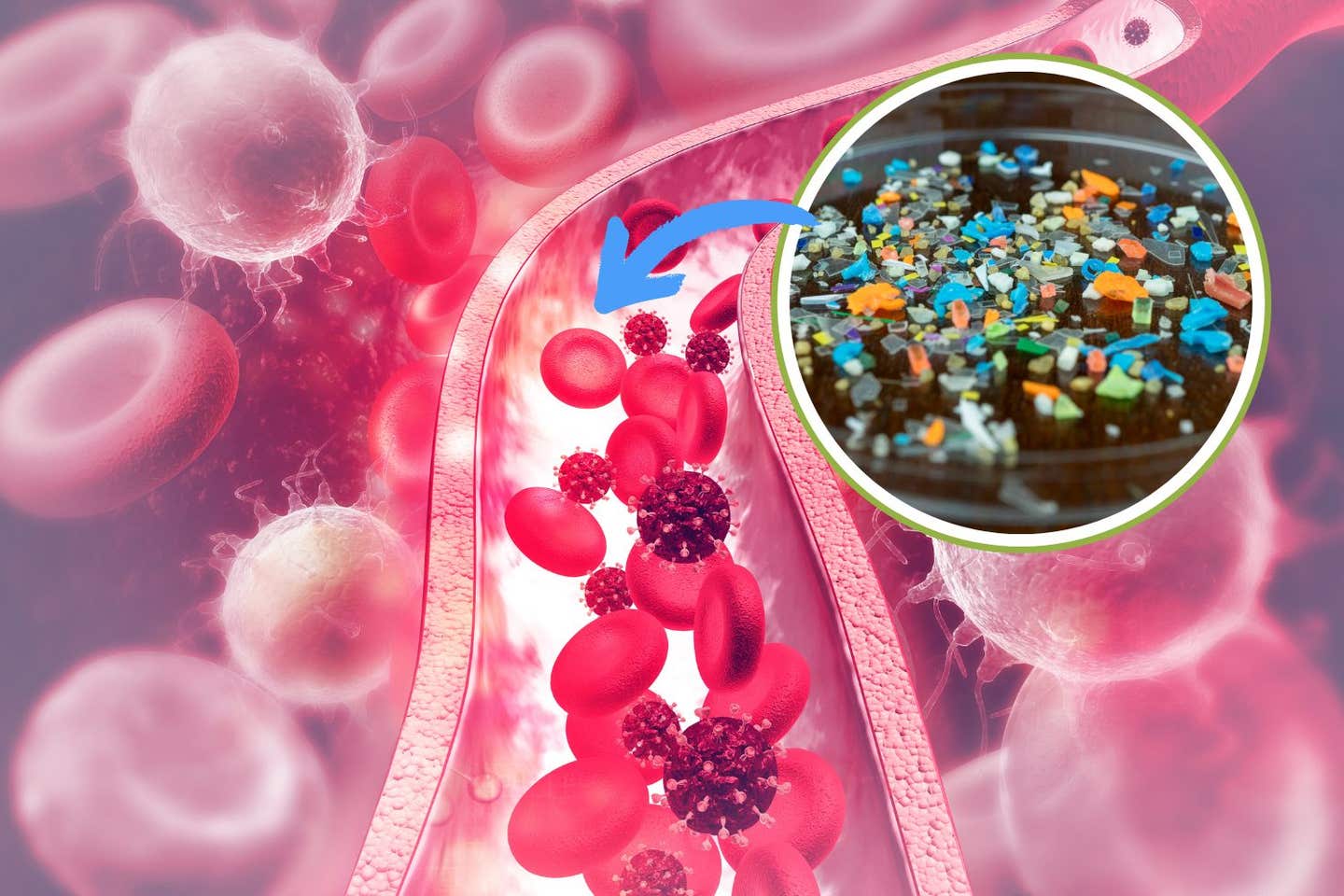 Scientists discover that gel-forming fiber supplements, taken with meals, could help the body excrete PFAS