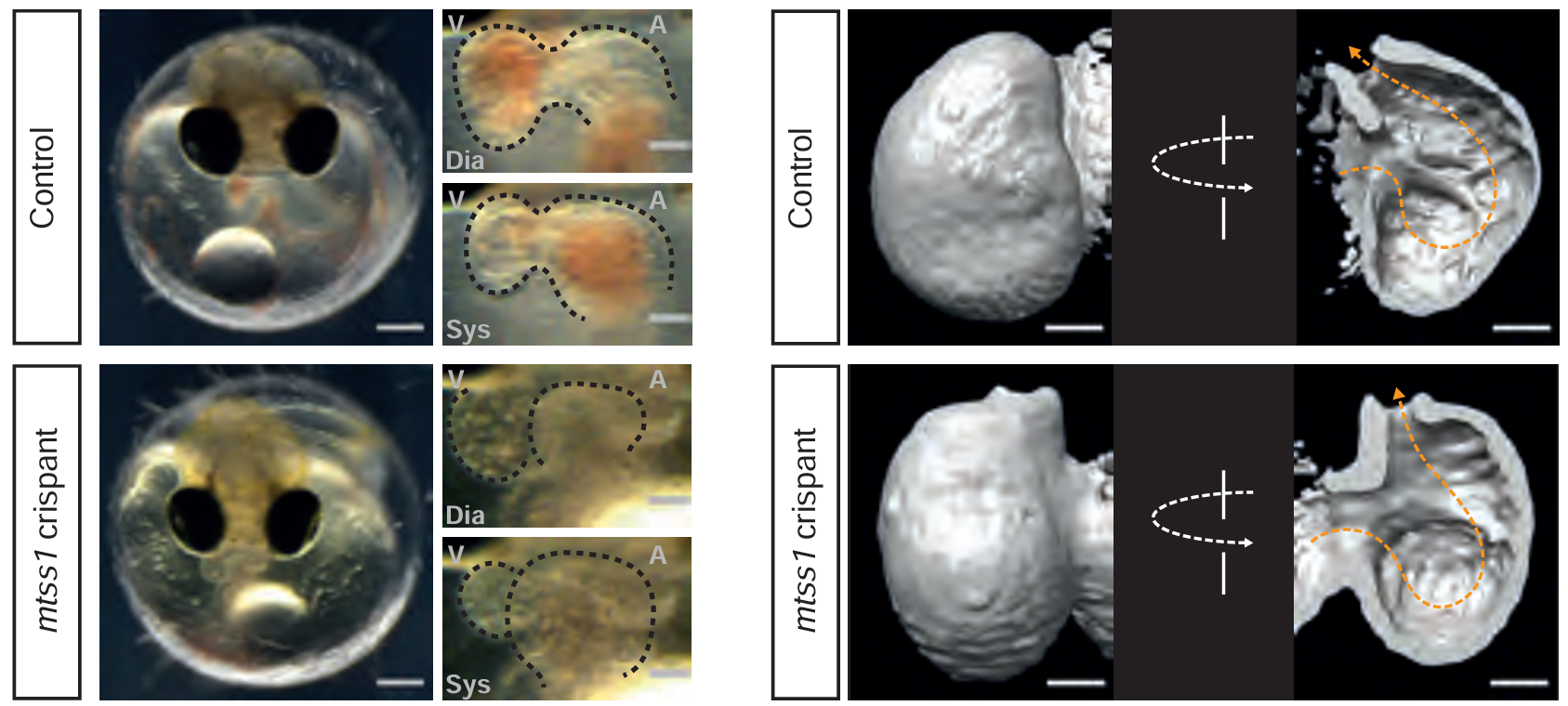 A moderately affected mtss1 crispant in comparison to a control embryo at 4 DPF; overview of injected embryos (left), magnifications of the heart region (right) captured in end-diastolic (Dia) and end-systolic (Sys) phase.