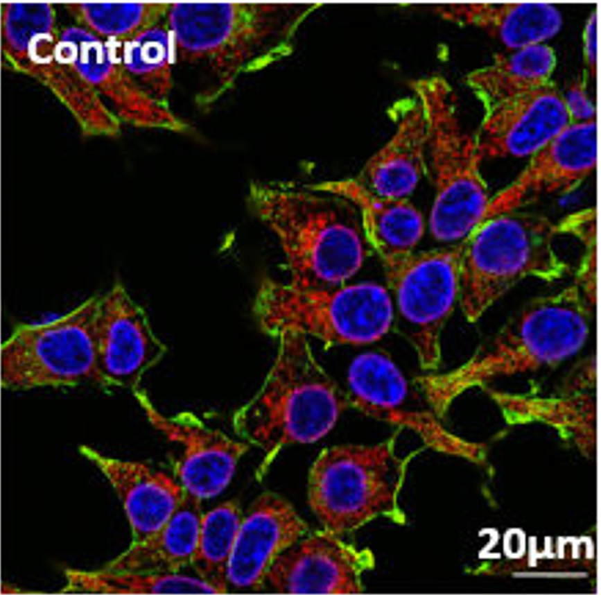 SEC61B overexpression or knockout resulted in increased ER calcium ef ux after treatment with puromycin or eeyarestatin I. 