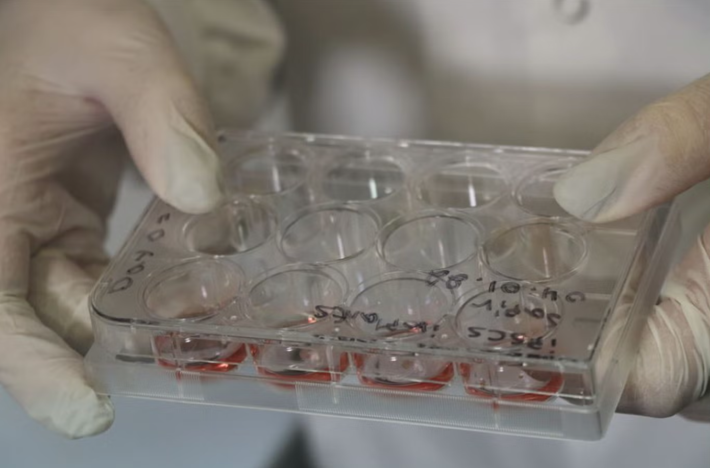 Petri dish with tissue samples.