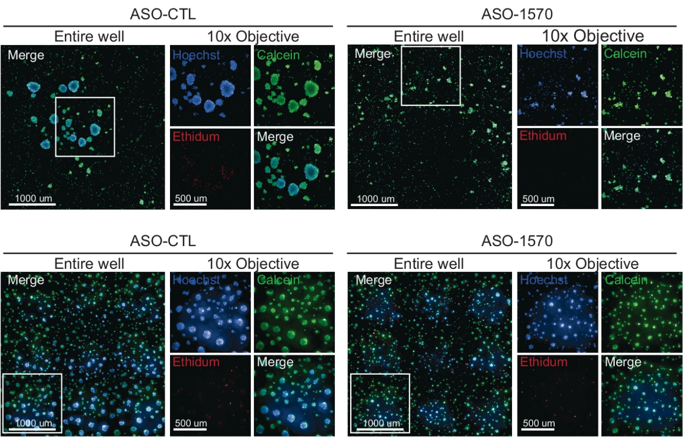 Cell viability and cell death are measured using calcein and ethidium homodimer stains in ASO-treated 3D-grown U87MG neurospheres