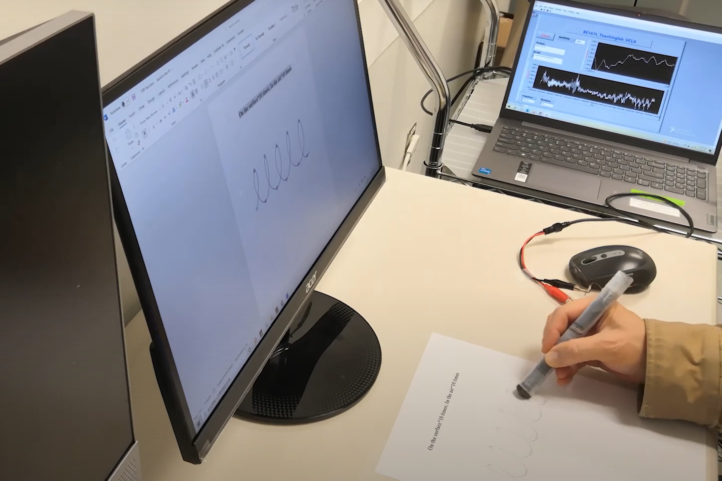 Smart pen tracks hand movements to detect Parkinson’s with 96% accuracy in early stages.