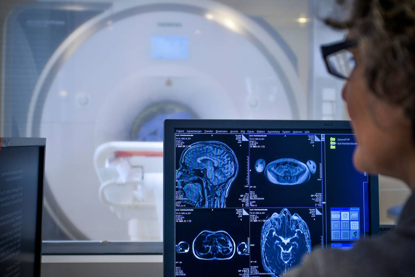 Researchers used ultra-high-resolution brain scans and animal studies to explore how this stacked architecture changes across a lifetime.