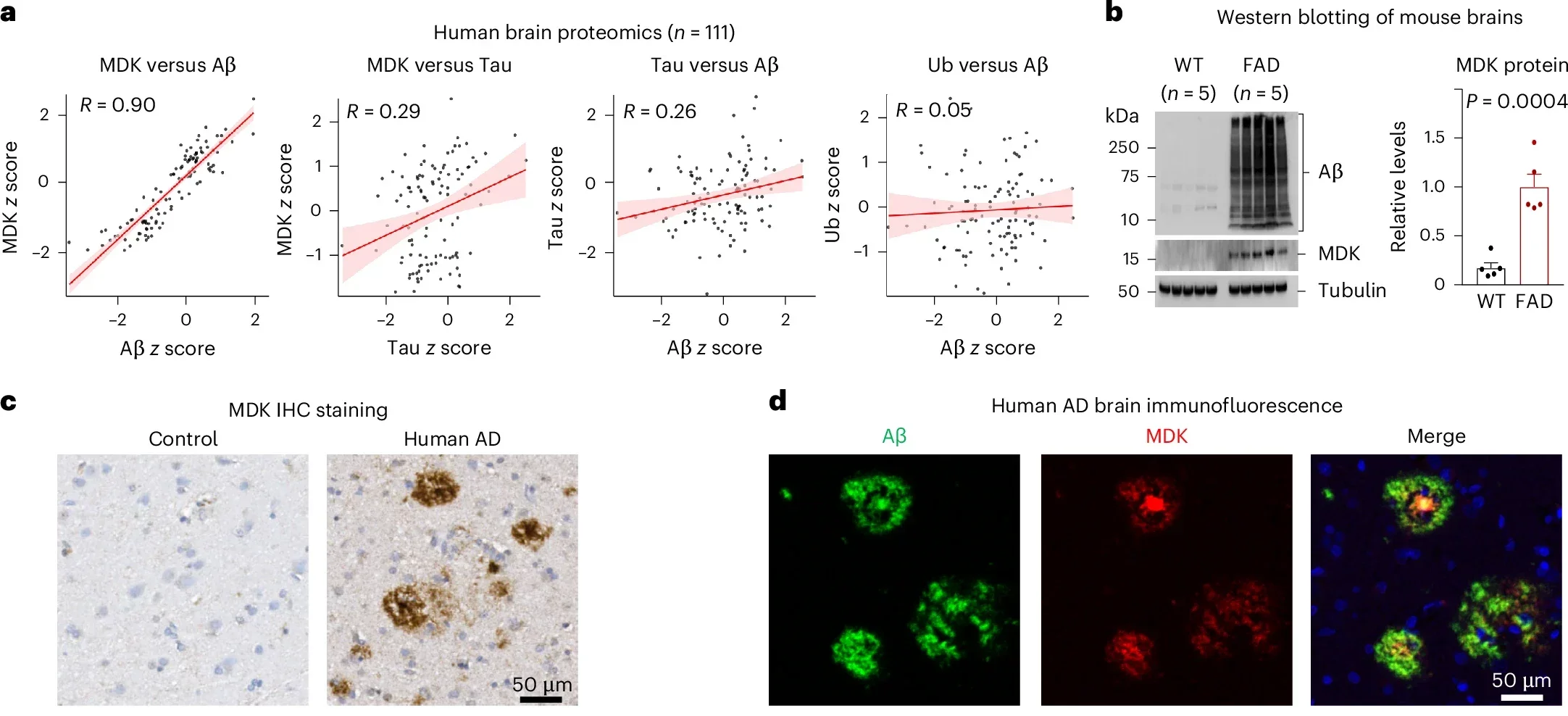 MDK is highly correlated and colocalized with Aβ in AD and in the FAD mouse model.