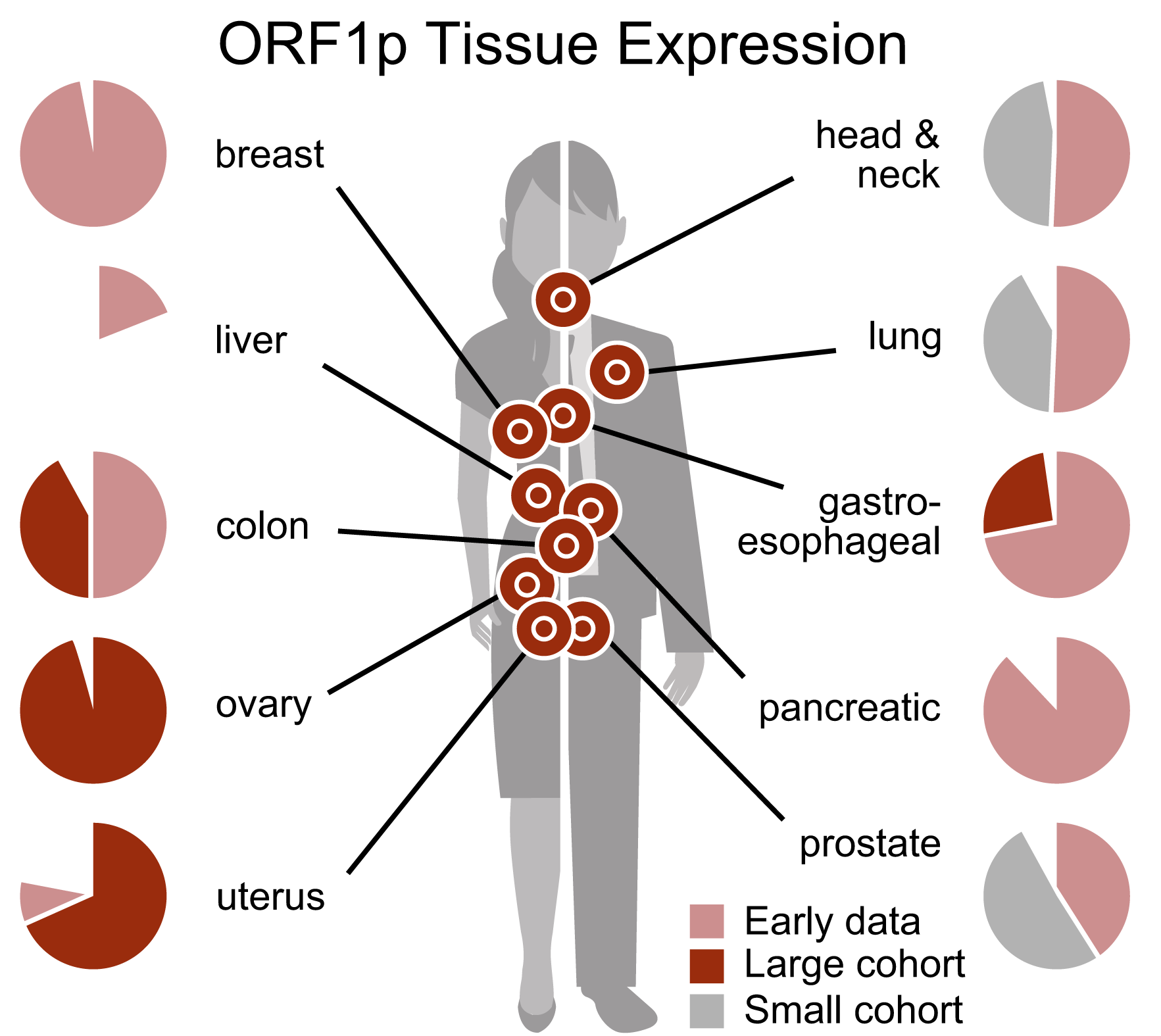 Summary overview of current data on ORF1p tissue expression in carcinomas (by IHC)