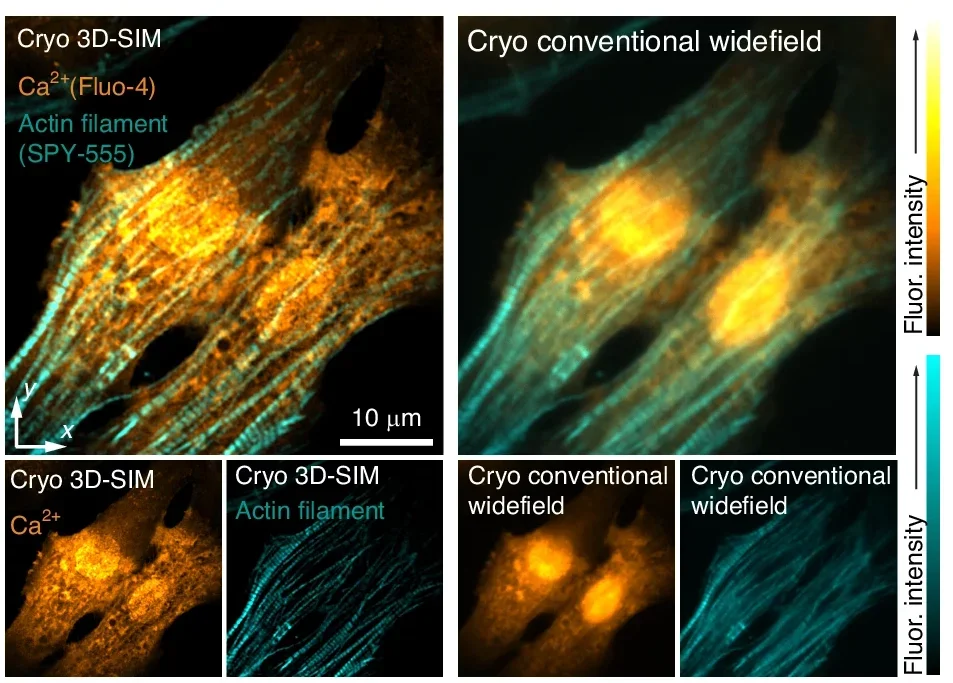 Cryogenic dual-color super-resolution and conventional widefield fluorescence images of Ca2+ distribution and actin filaments in the neonatal rat cardiomyocytes.