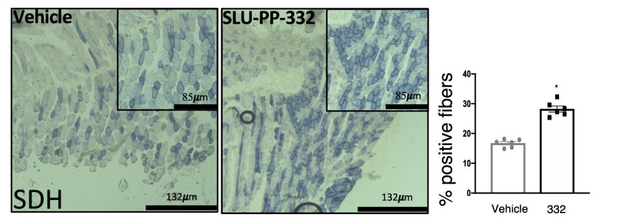 SLU-PP-332 increases oxidative fibers in skeletal muscle and improves exercise endurance.