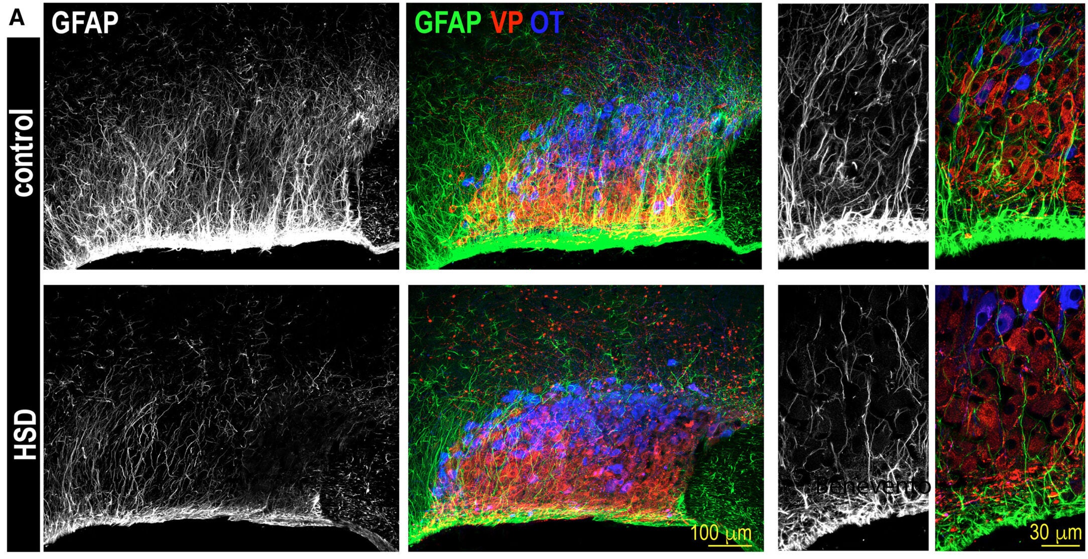 Rats fed HSD exhibit decreased astrocyte coverage