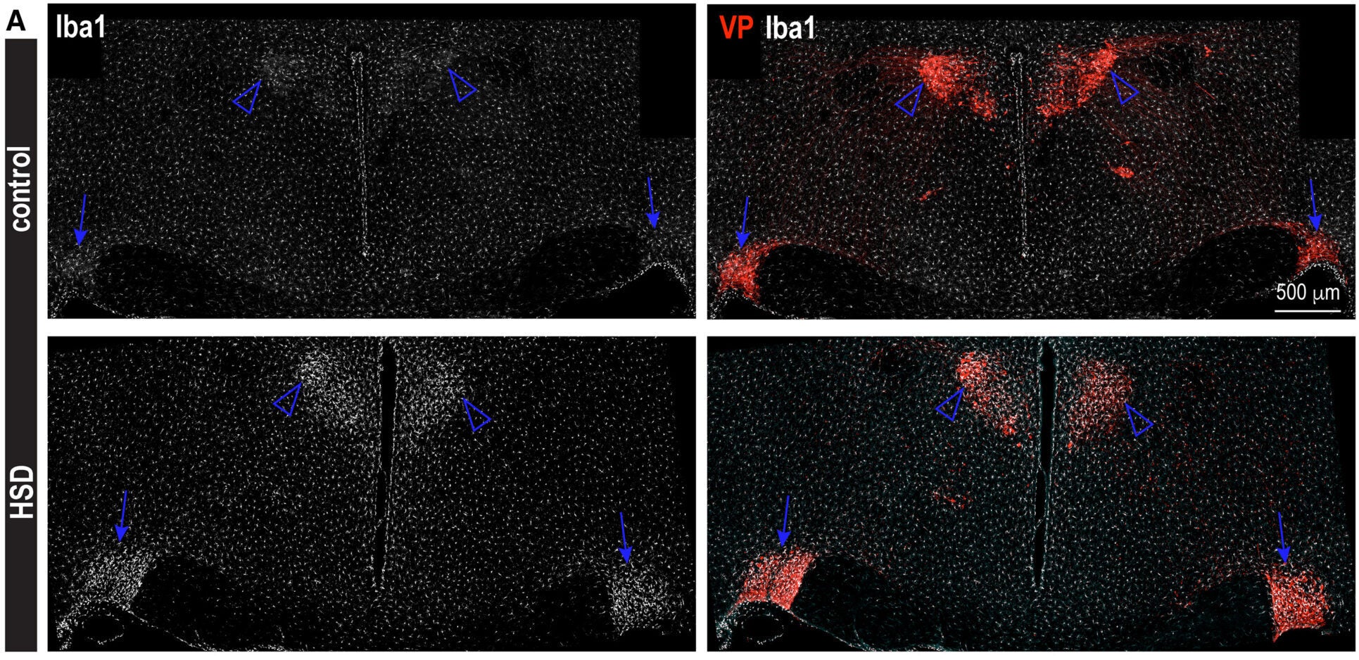 Local accumulation of reactive microglia in the SON and PVN of rats fed HSD