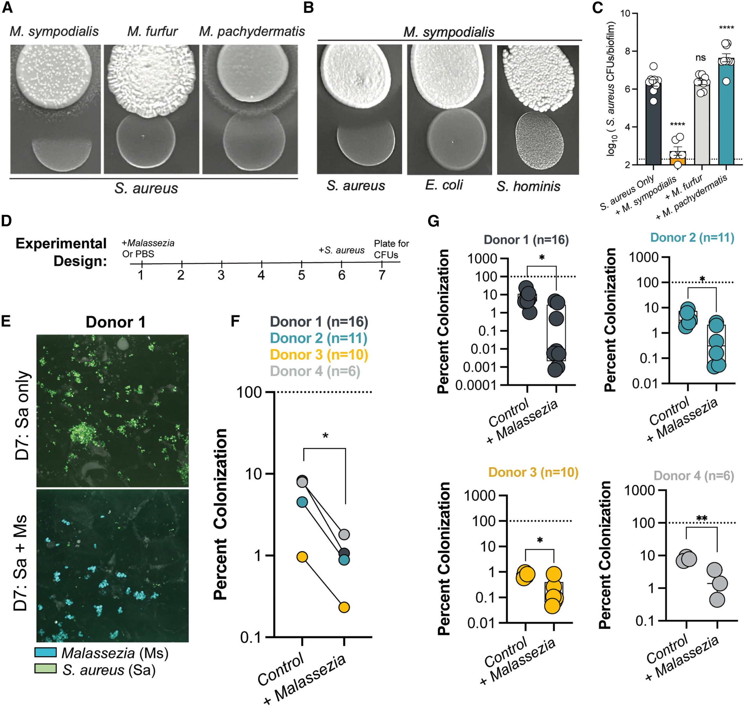 Malassezia sympodialis inhibits S. aureus in vitro and on human skin