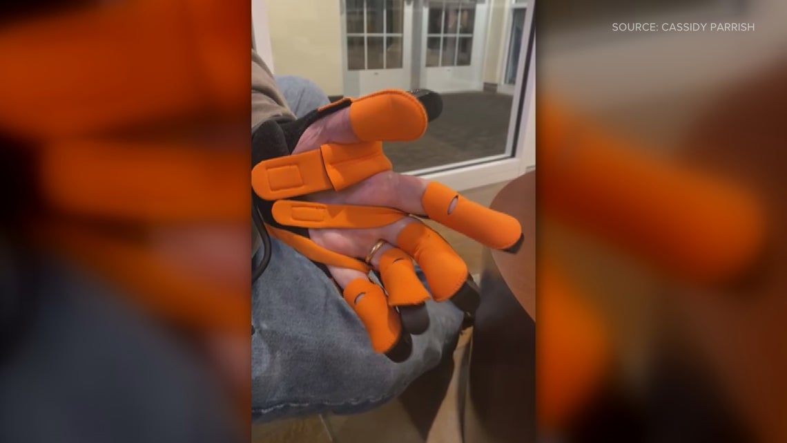 Researchers explored how soft robotics might help restore hand mobility. 