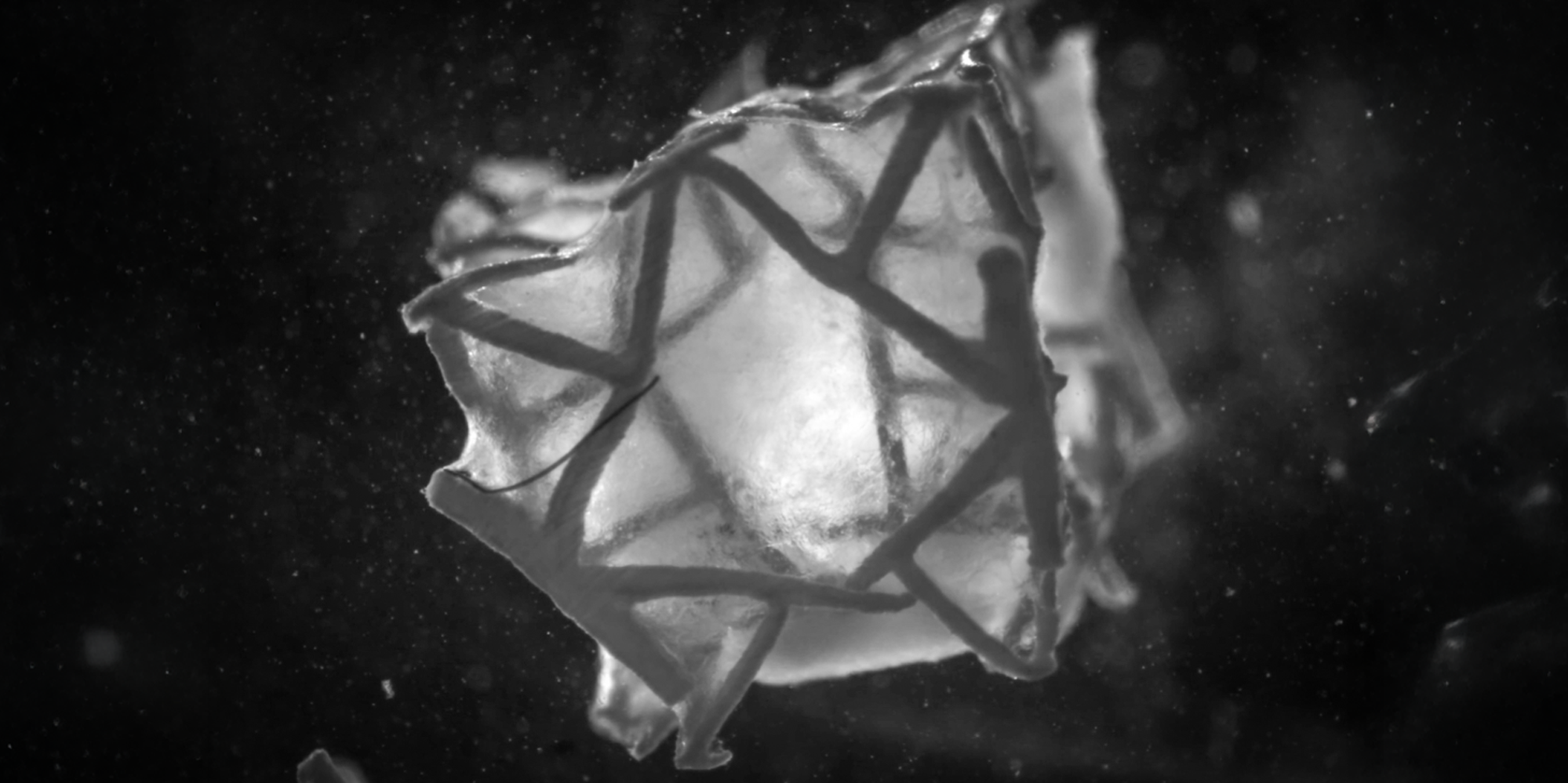 Illustration of the 3D-printed scaffold, which contracts in heart tissue.