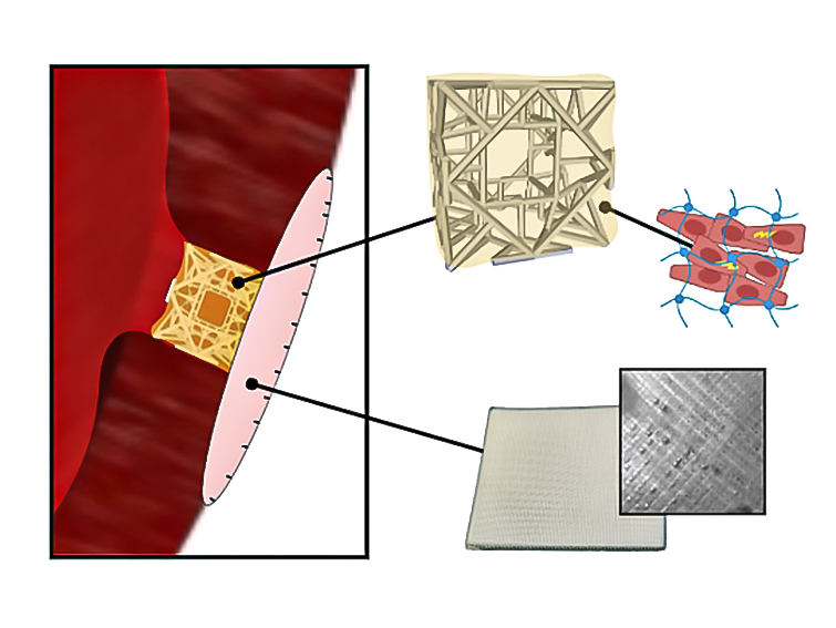 The graphic shows the structure of the RCPatch.