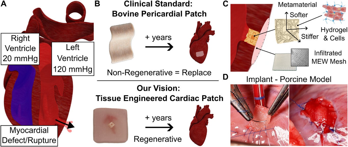 Overview of the Reinforced Cardiac Tissue Patch.