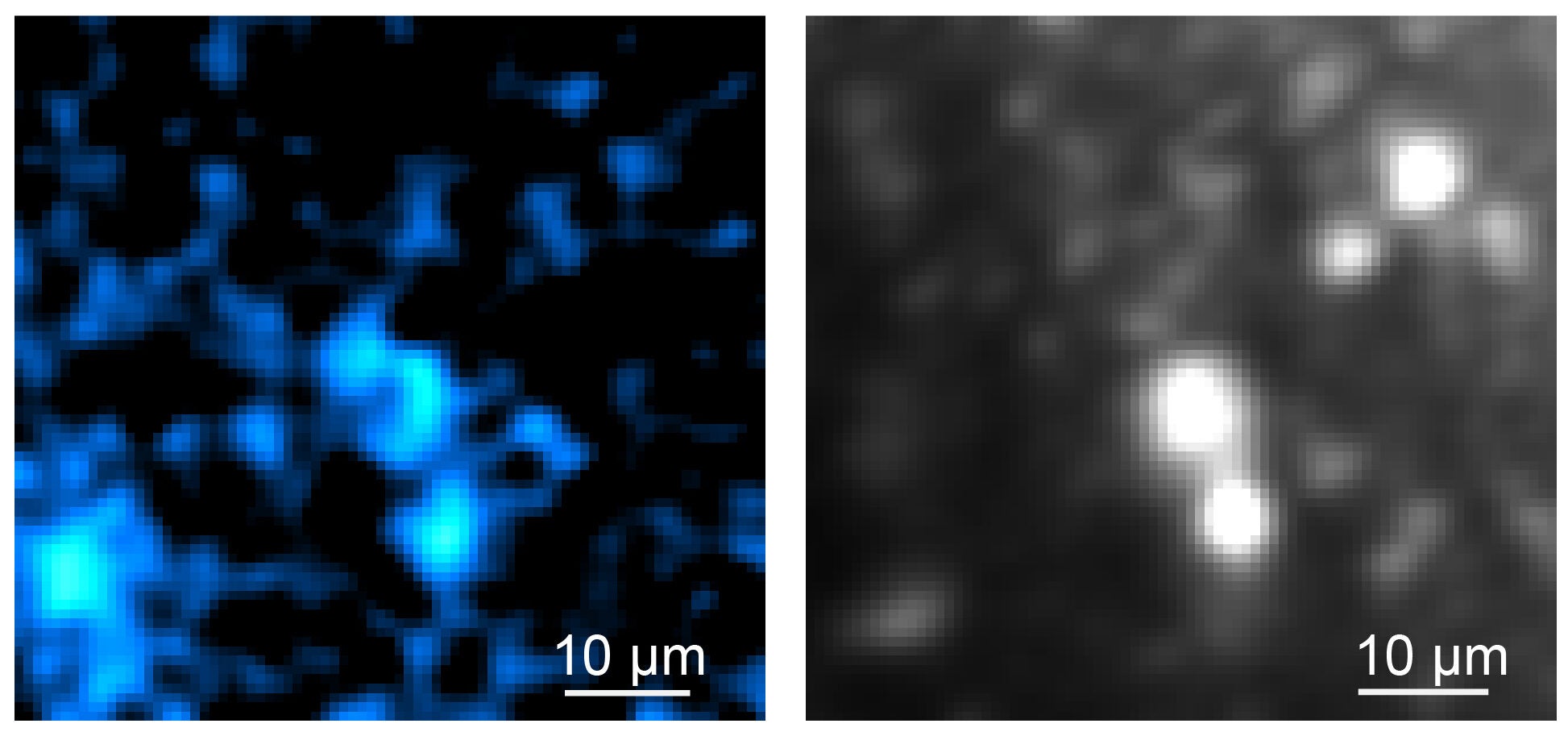 In this edited version of a figure from the research, NAD(P)H molecules within cells in a cerebral organoid are detected photoacoustically (in blue on left) and optically (black and white on right). Image depth 0.2 mm.