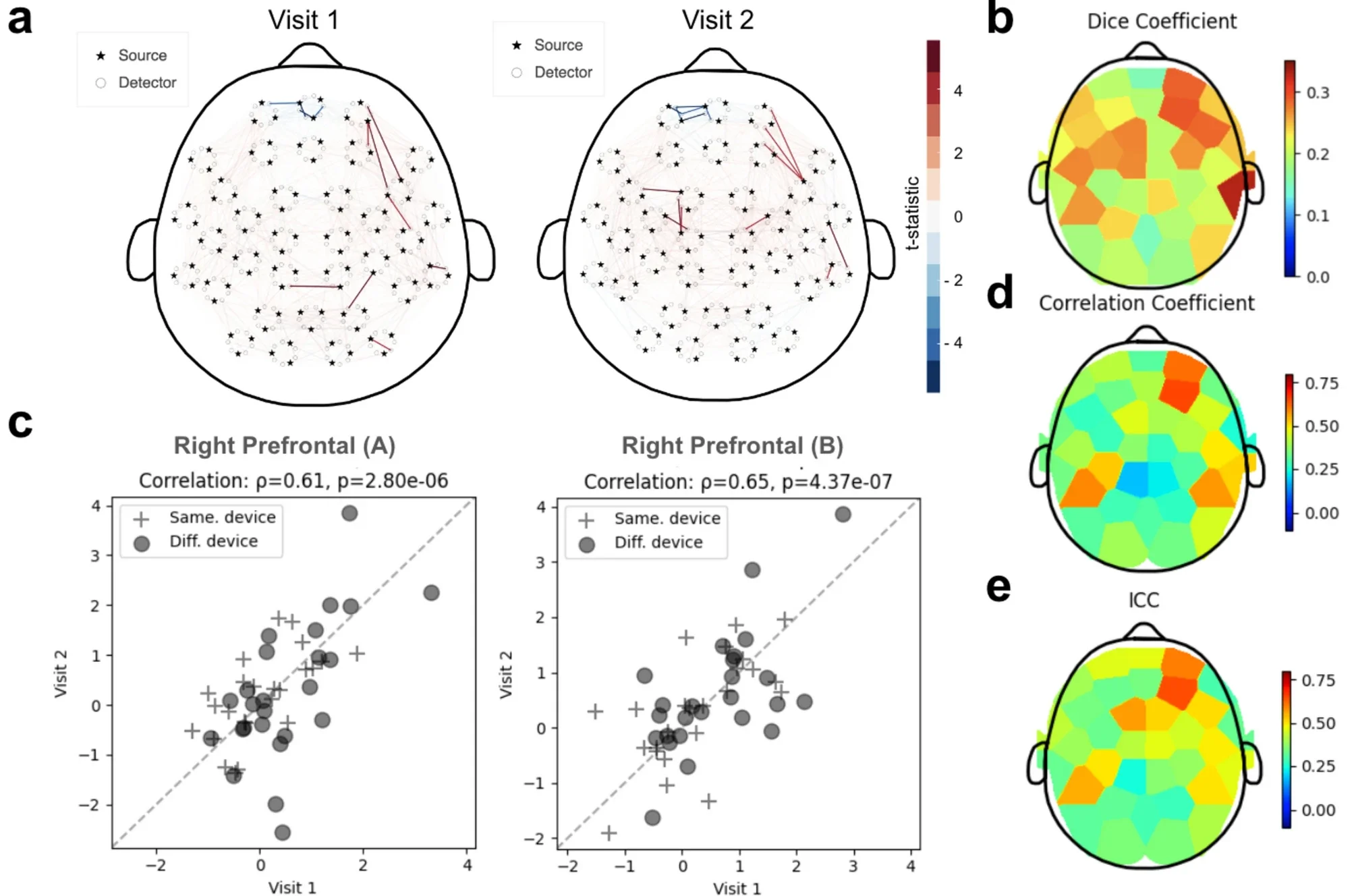 Reliability of the right prefrontal regions was observed in a Go/No-Go inhibitory control task.