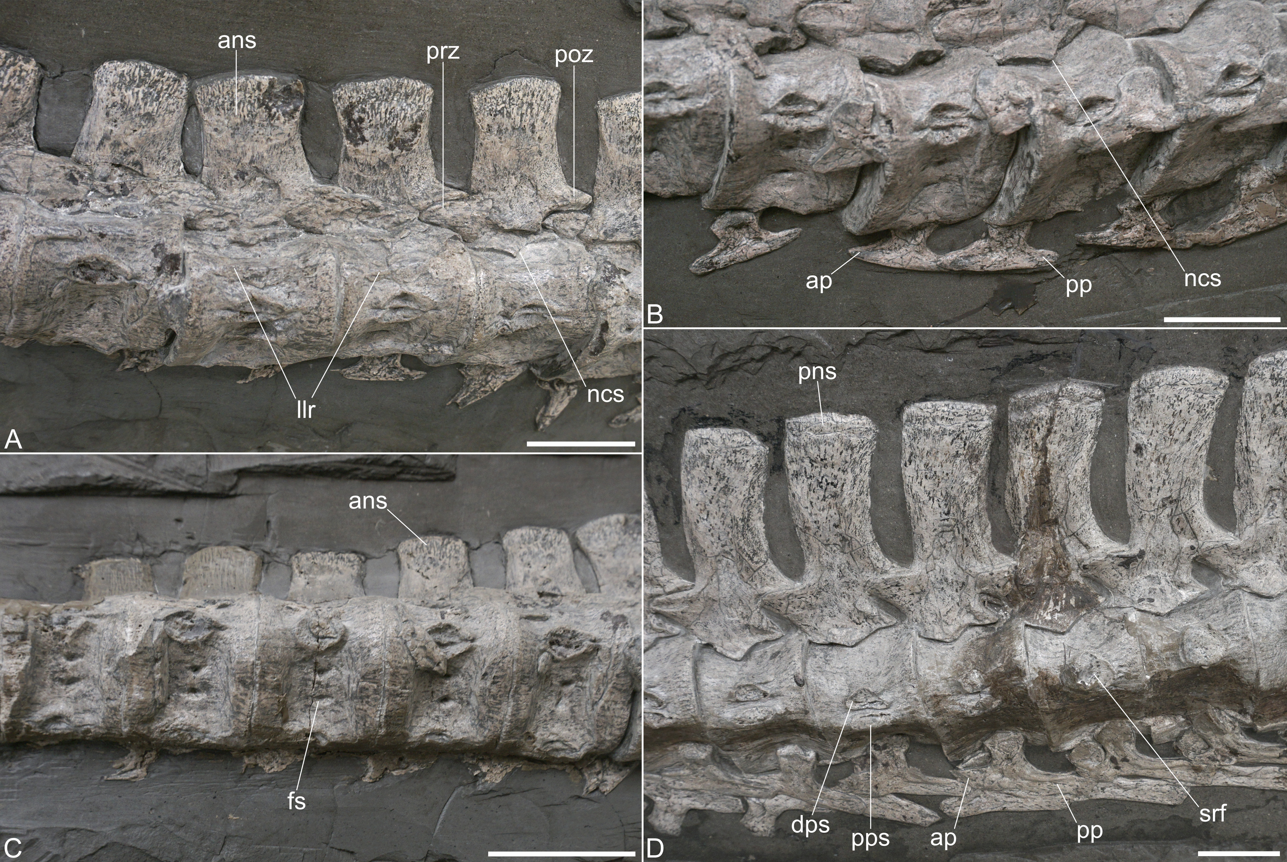 Cervical vertebrae of Plesionectes longicollum