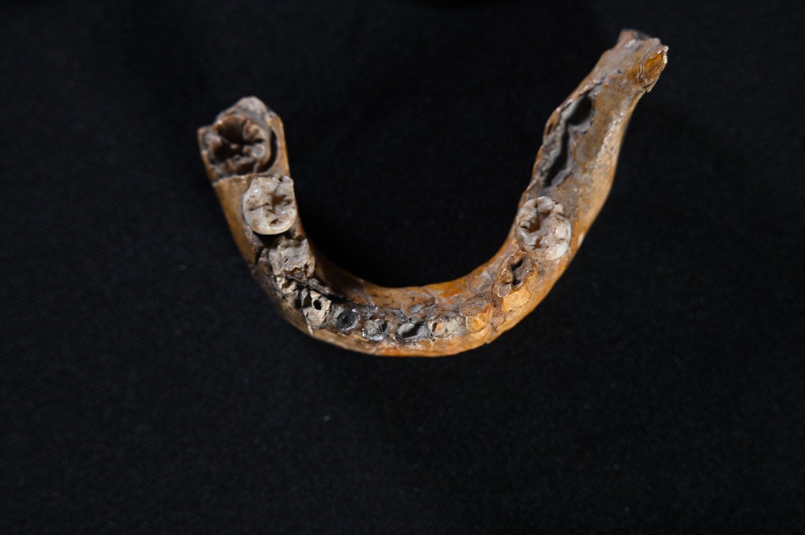 The lower jaw of Skhul I child showing features characteristics of Neanderthals