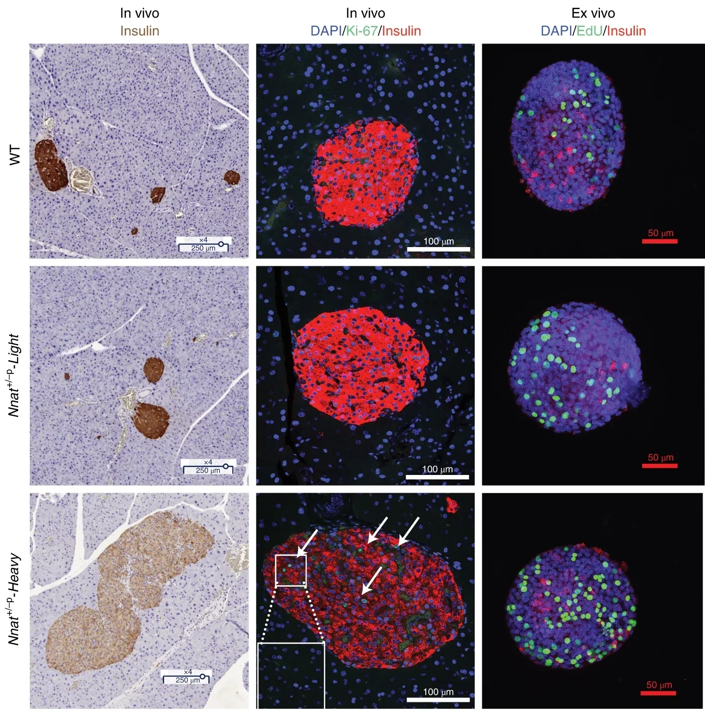 Nnat+/-p-overgrowth exhibits autonomous β-cell hyperplasia and hyperinsulinemia.