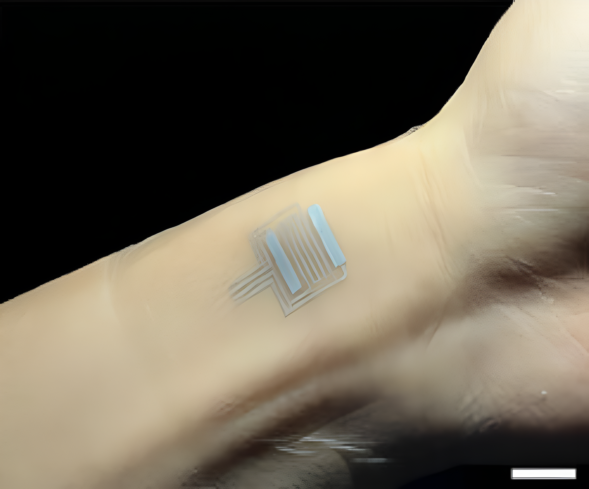 The skin patch developed by the research team.