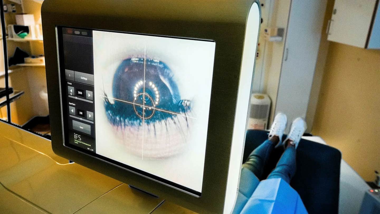 Scientists have created a bioengineered pig-skin corneal implant that restored sight in blind patients