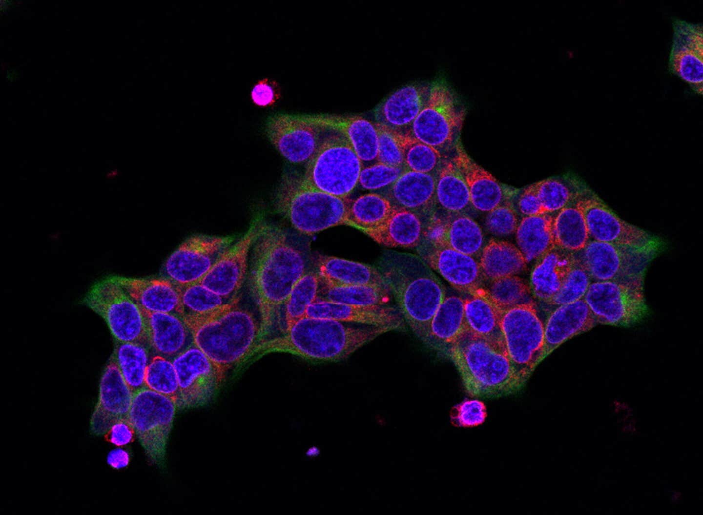 SEC61B (red) is overexpressed in a HEK293 cell line (tubulin in green, nuclear staining in blue) for functional assays.