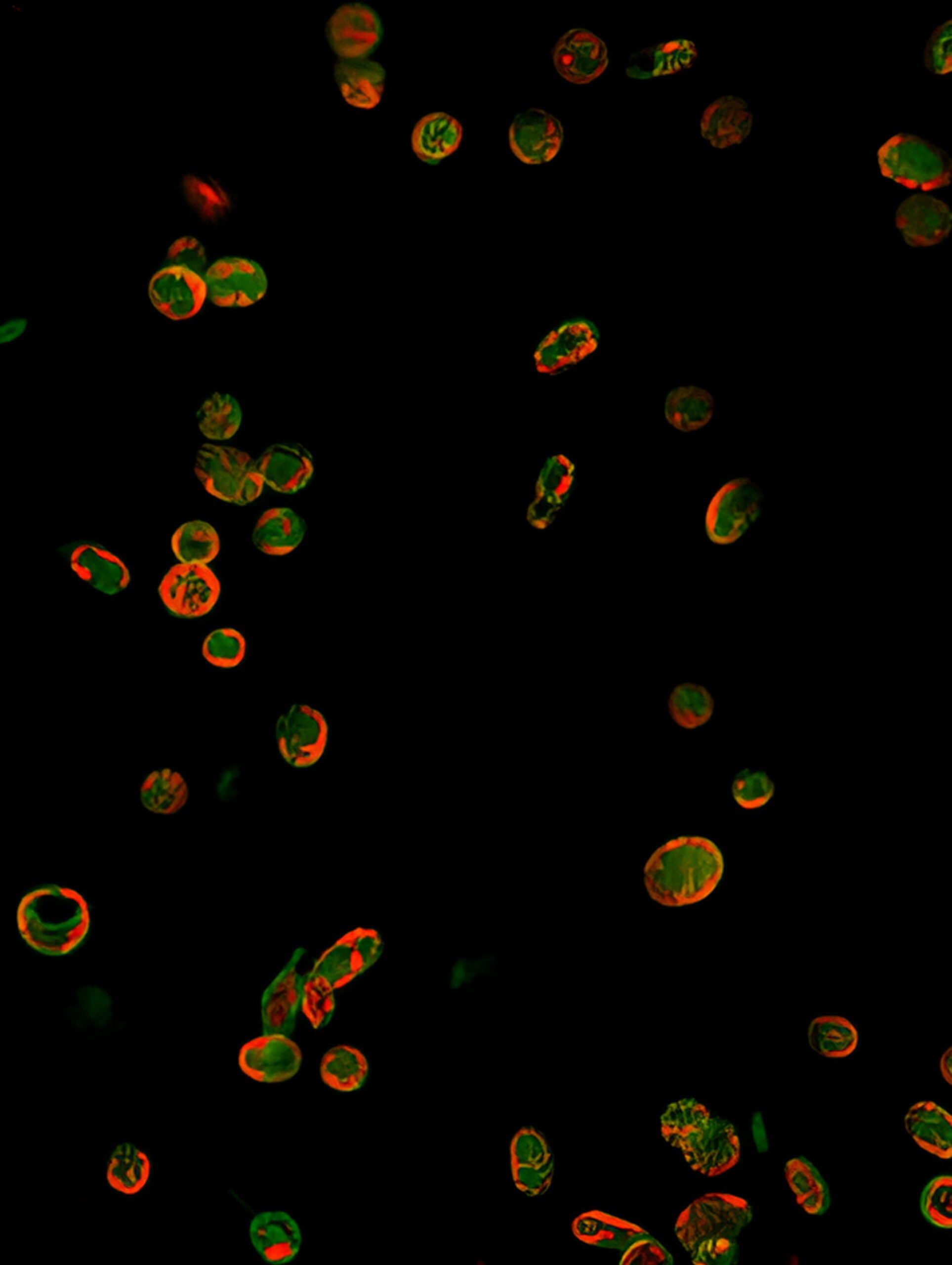 SEC61B (red) is seen in platelets (green) in diabetic mice. 
