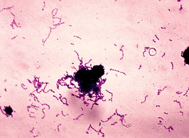 Streptococcus mutans. Gram stain. Thioglycollate broth culture. Morphology is rod-like with chains when cultured on broth. Can cause subacute bacterial endocarditis and dental caries.