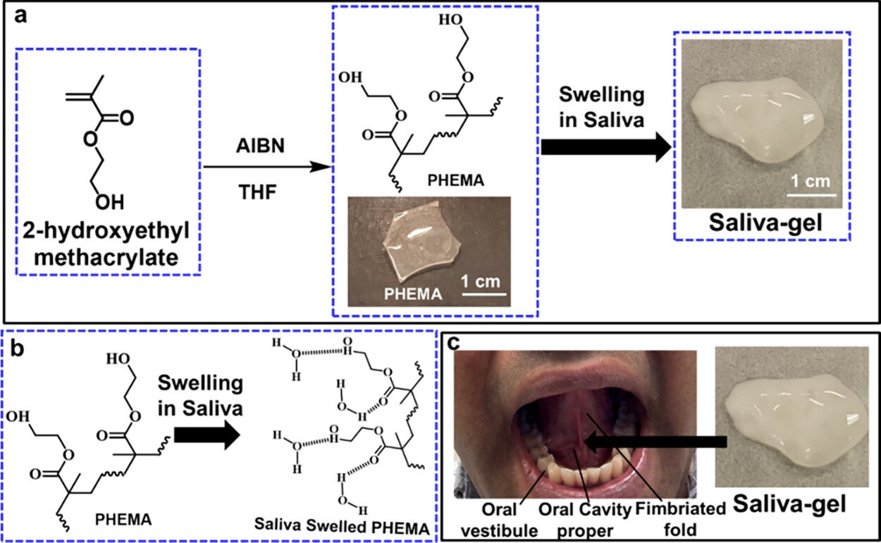 Synthetic Scheme for the Creation of PHEMA-Based Saliva-Gels from 2-Hydroxyethyl Methacrylate