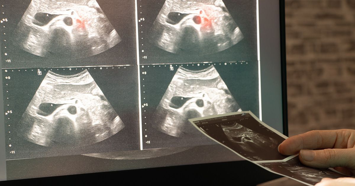 Scientists have created an AI tool that could help doctors identify diseases quickly and accurately using only a small number of medical images.