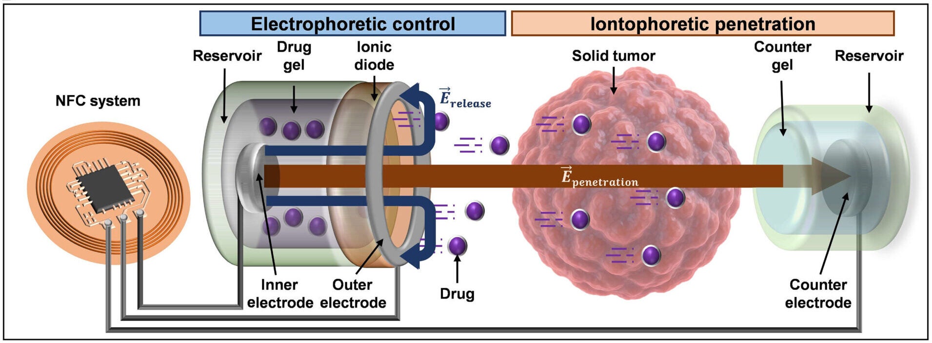 Schematic of a dual-phoretic wireless chemotherapeutic device. The drug release compartment controls electrophoretically on-demand drug release in response to the direction of the electric field.