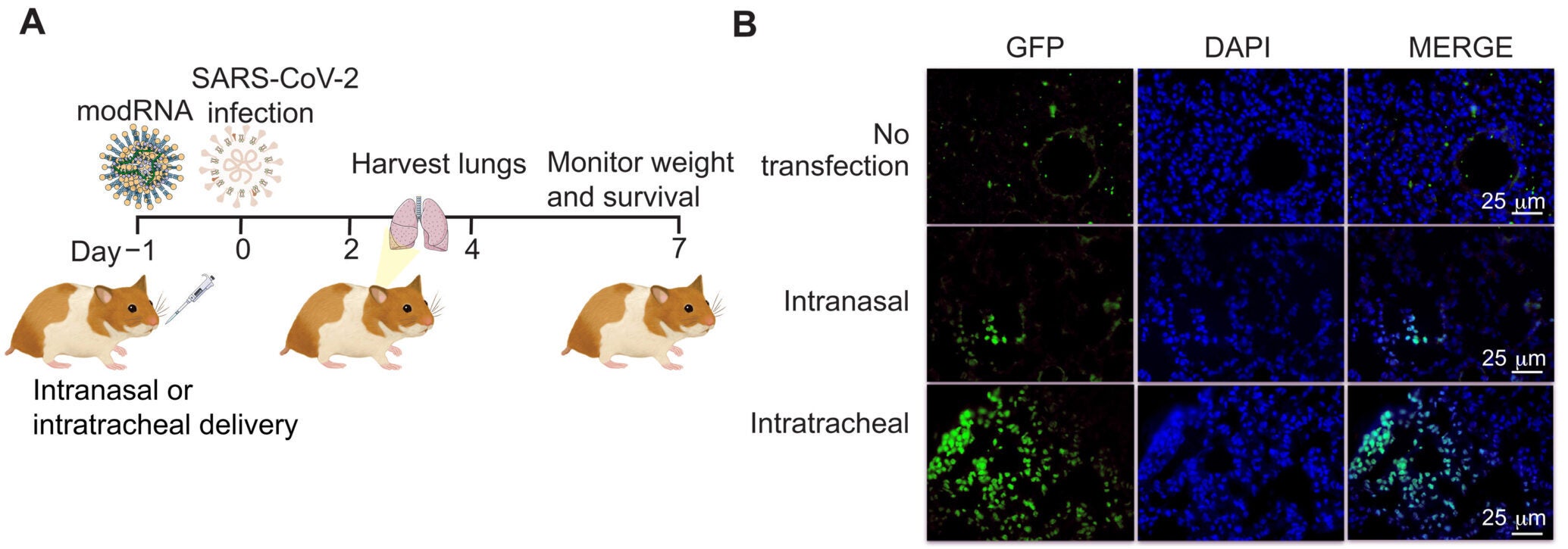 Intranasal delivery of synthetically modified RNA encoding 10-ISG collection is sufficient to restrict SARS-CoV-2 in vivo.