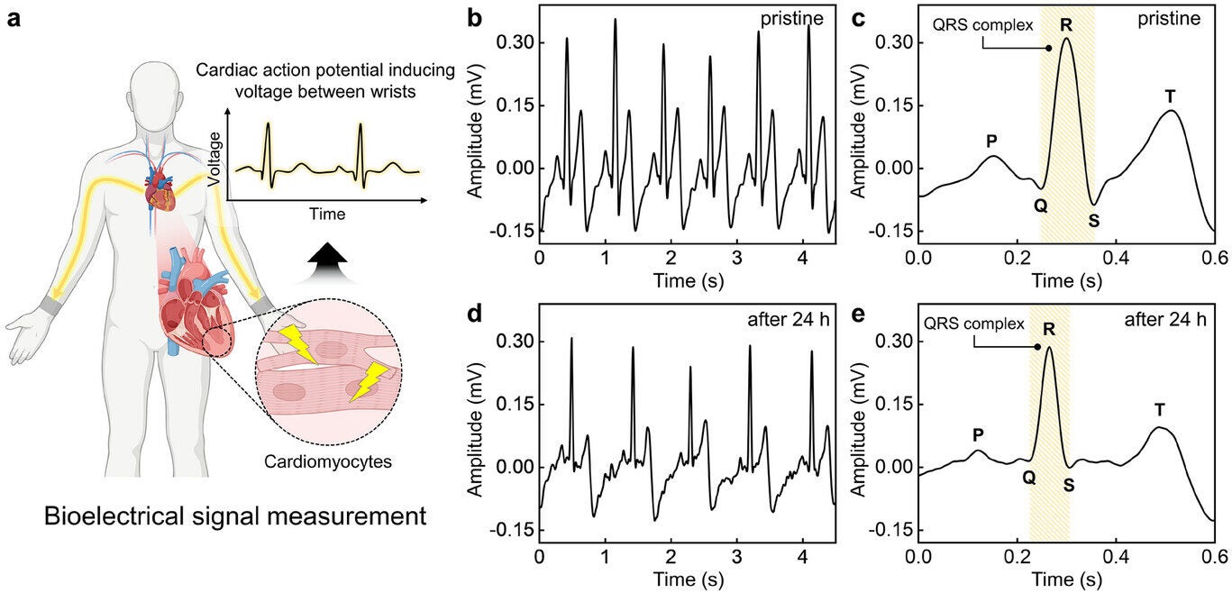 Biosignals measurement of laser-sintered liquid metal biosignal sensors. a) Schematic illustration of the bioelectrical signal measurement. b) ECG signals are measured using bioelectrical sensors in their pristine state.