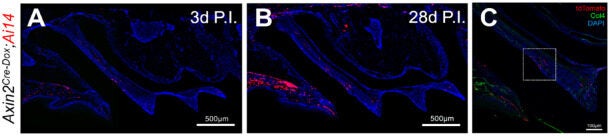 Lineage tracing Axin2-tdTomato+ cells in the dental pulp.