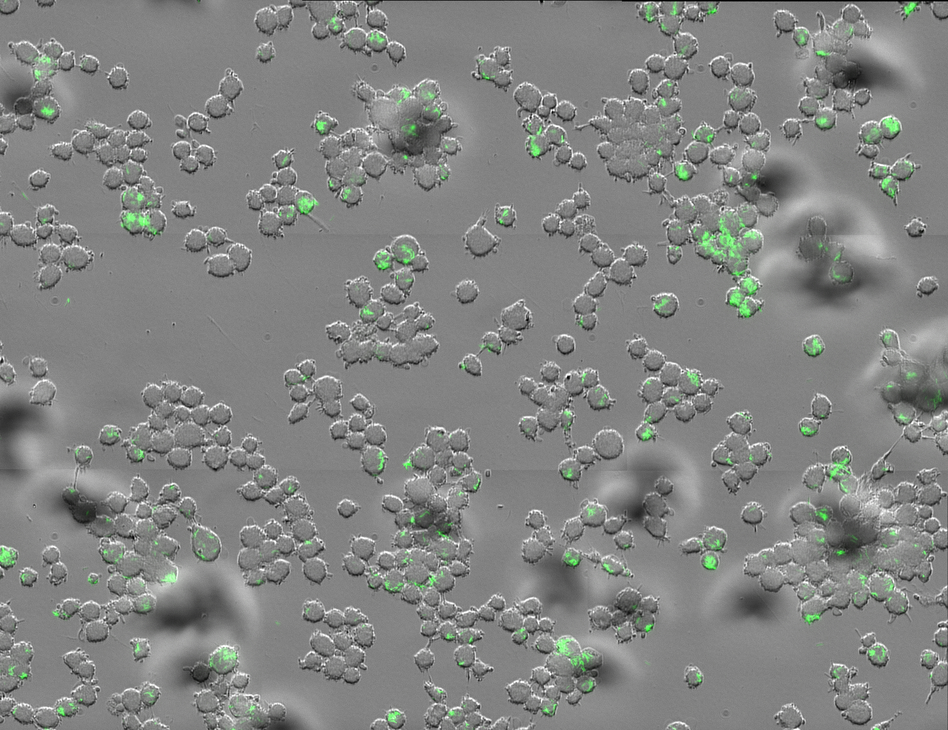 Mycobacterium tuberculosis (green) inside human immune cells known as macrophages. 