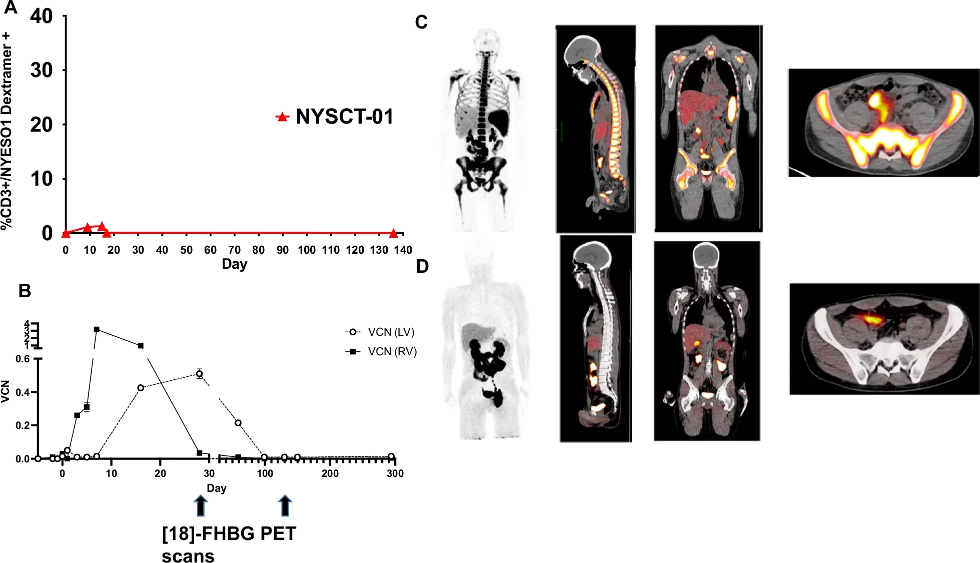 Retroviral and lentiviral-transduced cell engraftment kinetics in patient NYSCT-01.