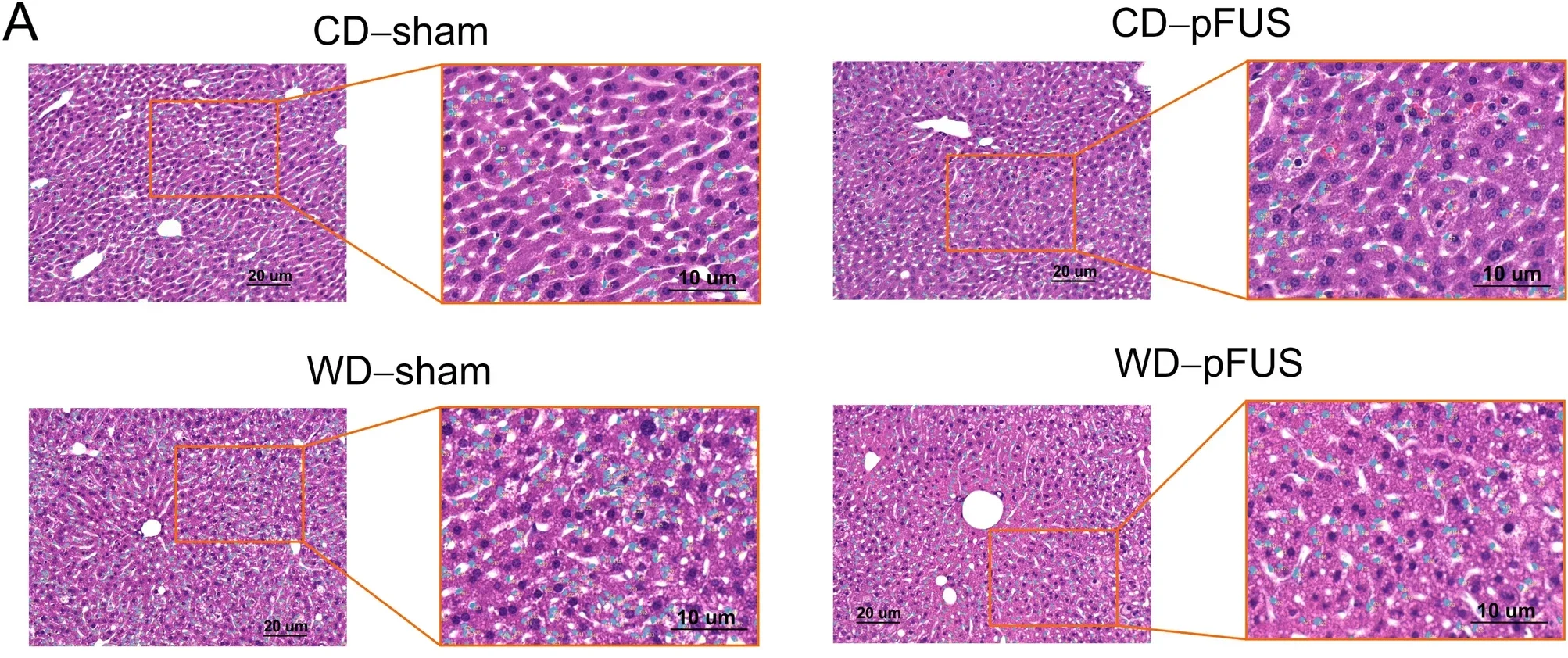 Representative images of H&E stained sections with semi-automated mask for counting immune cells.