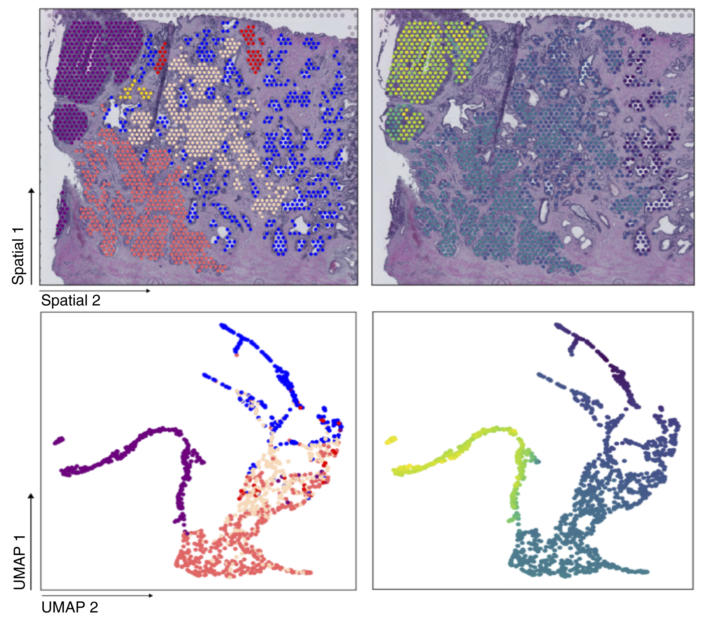The spatial plots and Uniform Manifold Approximation and Projection (UMAP) plots in MEND160. Each dot corresponds to one spot.