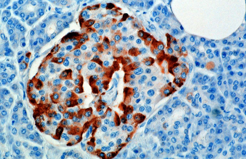 Alpha cells in the pancreas produce GLP-1, reshaping our understanding of blood sugar control and diabetes care.