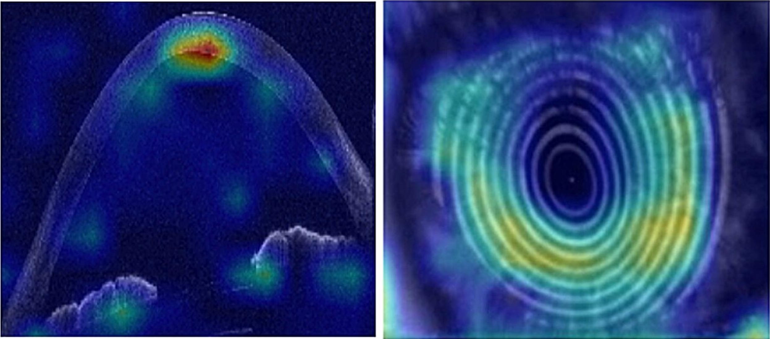 Example of OCT scan of eye used by AI. 